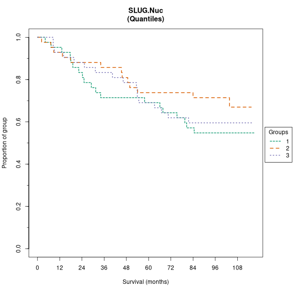 SLUG.Nuc (Kaplan-Meier (tertile) plots on Breast Cancer 1 (AQUA) dataset)